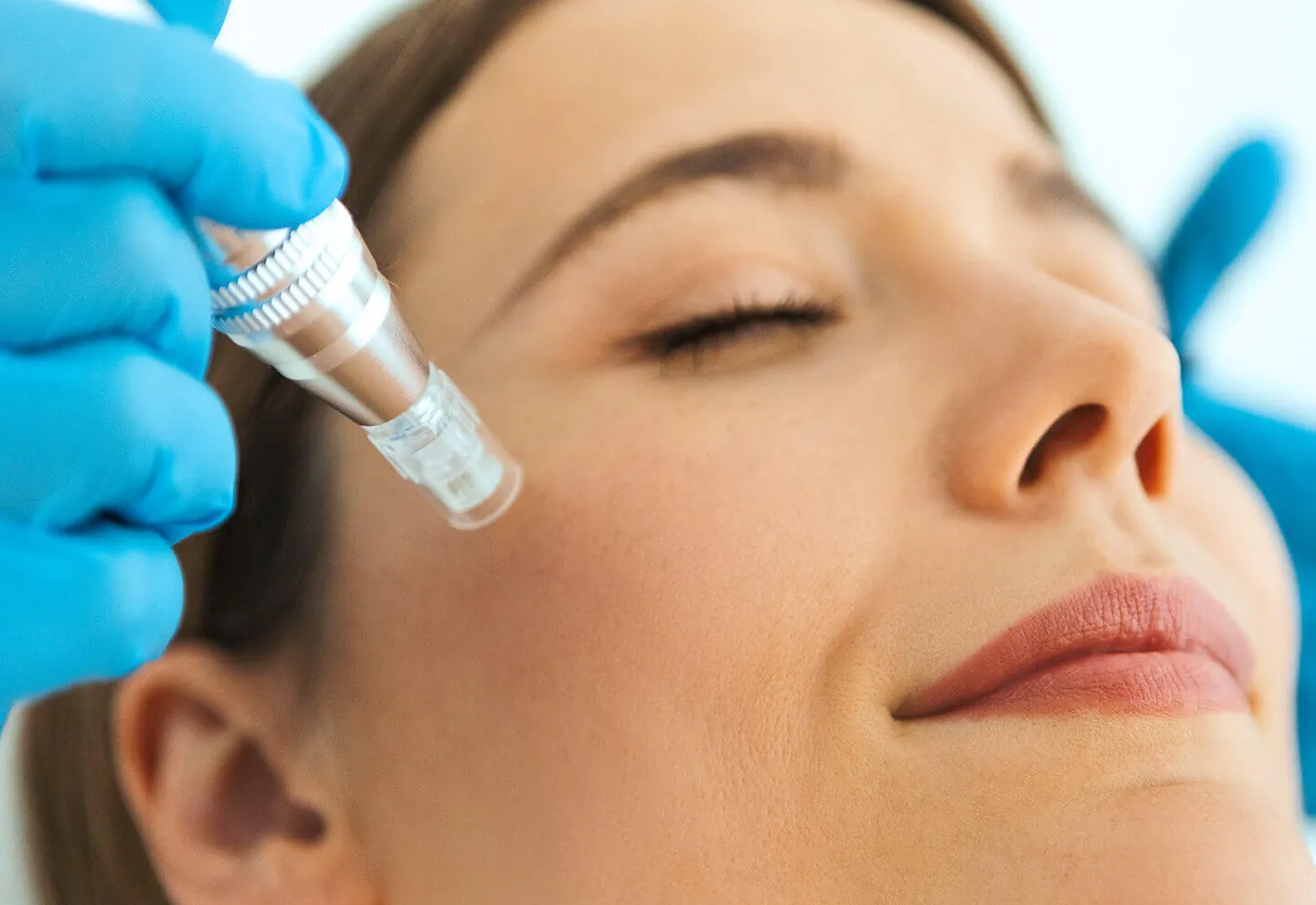 Transforma tu Piel con la Mesoterapia Facial